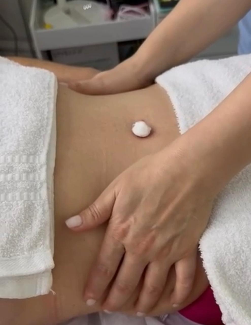 Drenagem Linfática